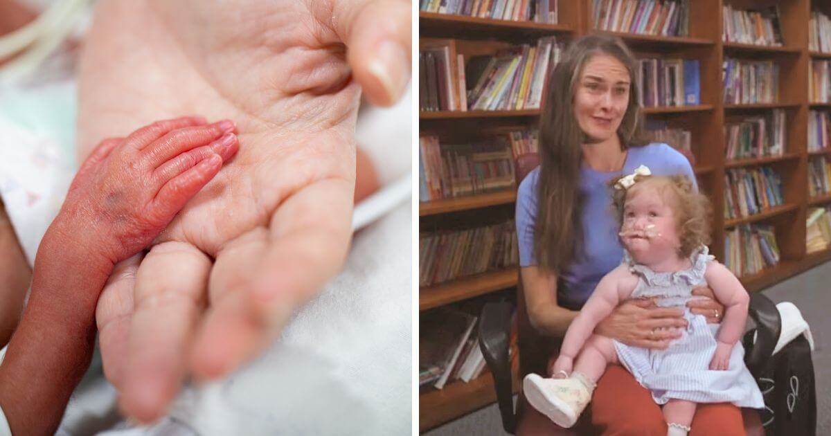 Premature baby born at just 25 weeks, weighing just over 1lb, reunites with hospital team who cared for her
