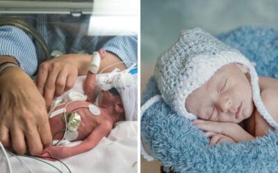 Premature baby born weighing barely more than a bag of sugar now thriving at 18 months