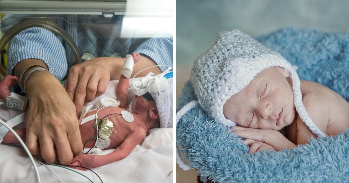 Premature baby born weighing barely more than a bag of sugar now thriving at 18 months Premature baby born weighing barely more than a bag of sugar now thriving at 18 months