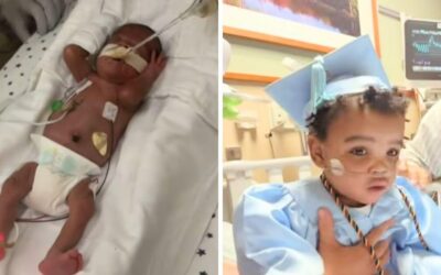 Premature baby breaks hospital record for longest stay after birth before going home