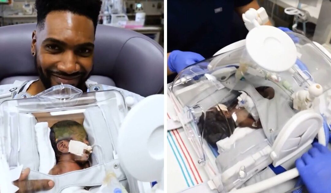 ‘Skincubator’ allows premmie twins born at 26 weeks to receive ‘kangaroo care’