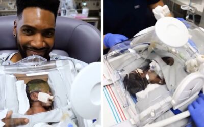 ‘Skincubator’ allows premmie twins born at 26 weeks to receive ‘kangaroo care’