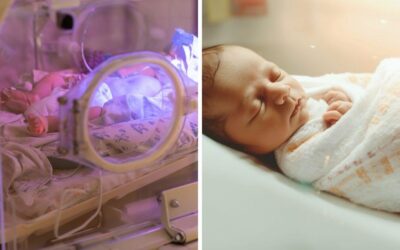 Tiny baby born prematurely at only 24 weeks’ gestation celebrates first birthday at home