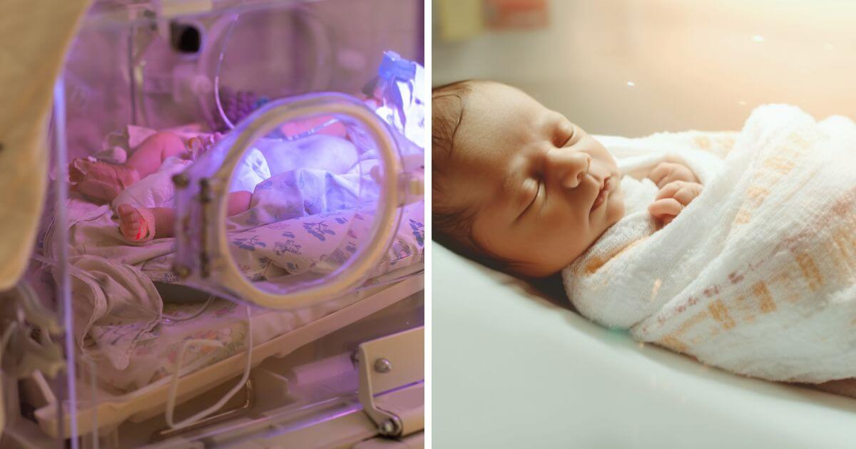 Tiny baby born prematurely at only 24 weeks’ gestation celebrates first birthday at homeaby-born-prematurely-at-only-24-weeks’-gestation-celebrates-first-birthday-at-home Tiny baby born prematurely at only 24 weeks’ gestation celebrates first birthday at home